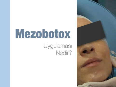 Mezobotox